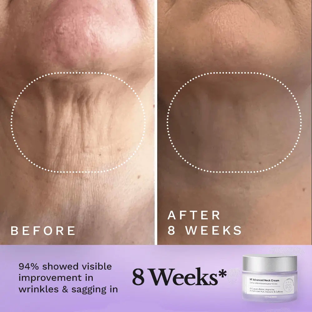 NF Advanced Neck Cream